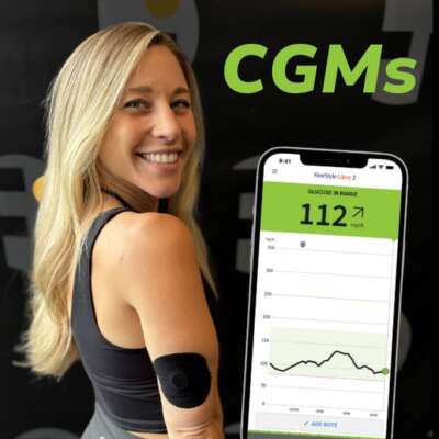 CGM